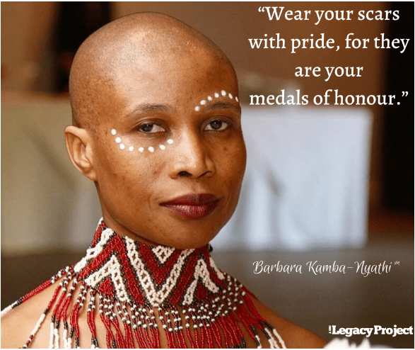 Barbara Kamba-Nyathi